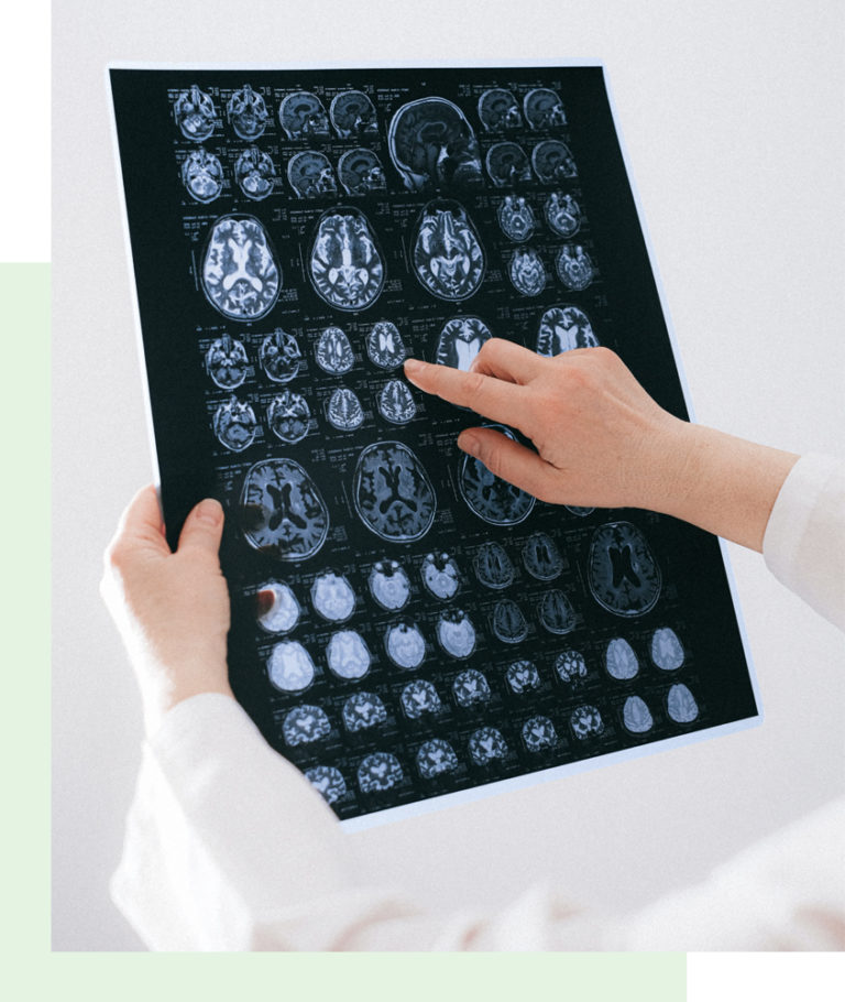 WSS Wisconsin Sleep Society